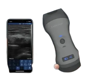 Occulus Wireless Ultrasound