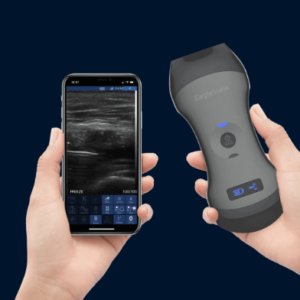 Occulus Wireless Ultrasound